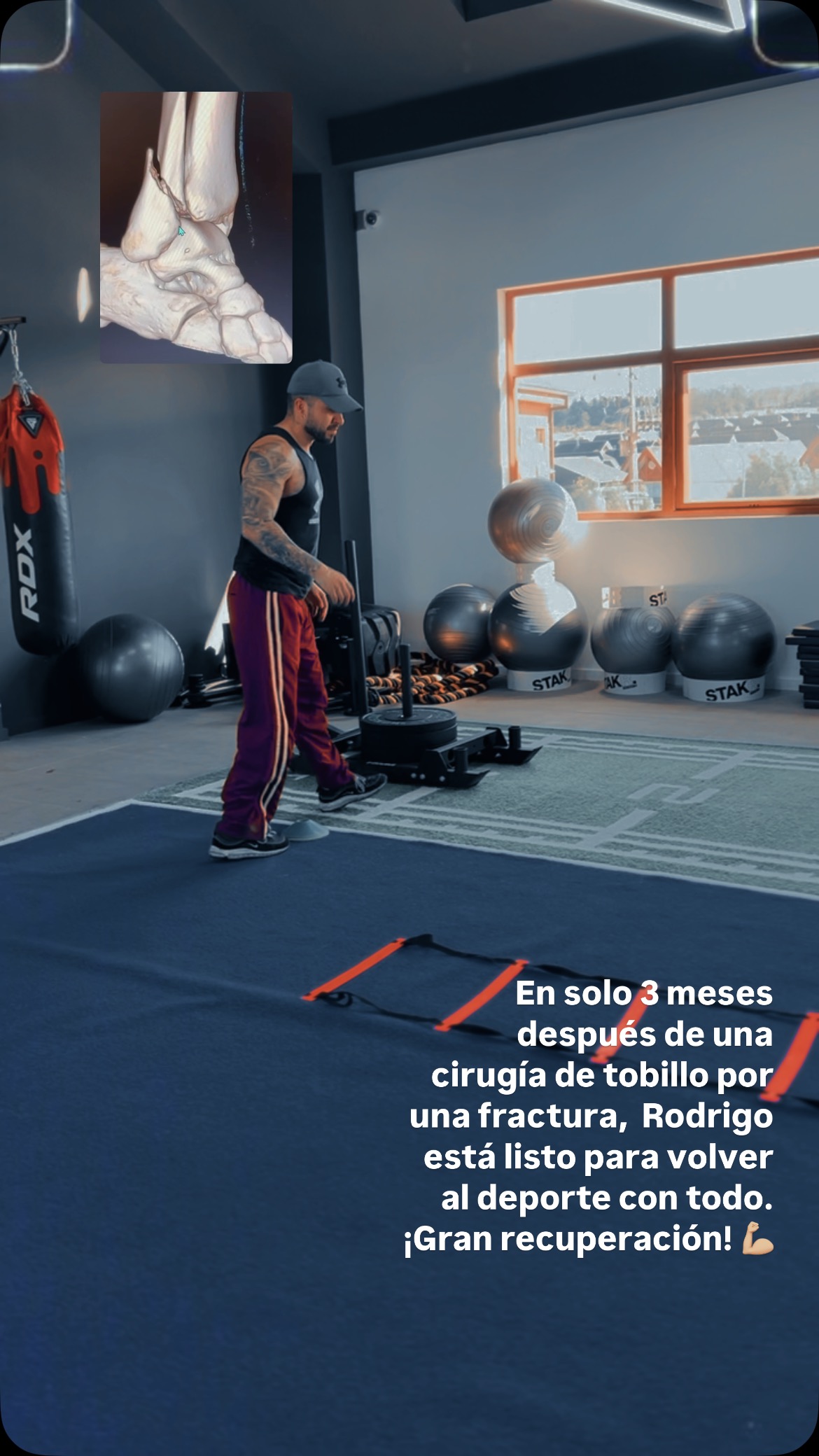 Paciente en un espacio de rehabilitación equipado para ejercicio funcional